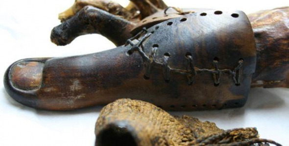 Prostheses in Antiquity: Everything You Never Knew You Wanted to Know